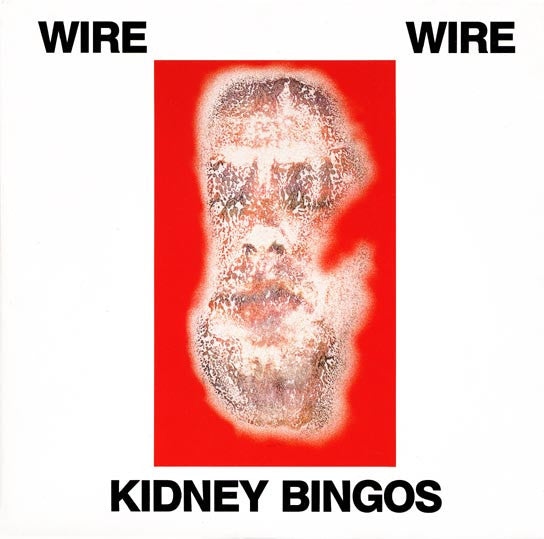 Wire - Kidney Bingos